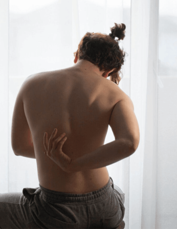 arnica
